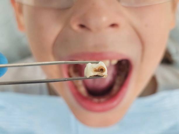 Best Urgent Dental Care for Toothache in Eastover, NC